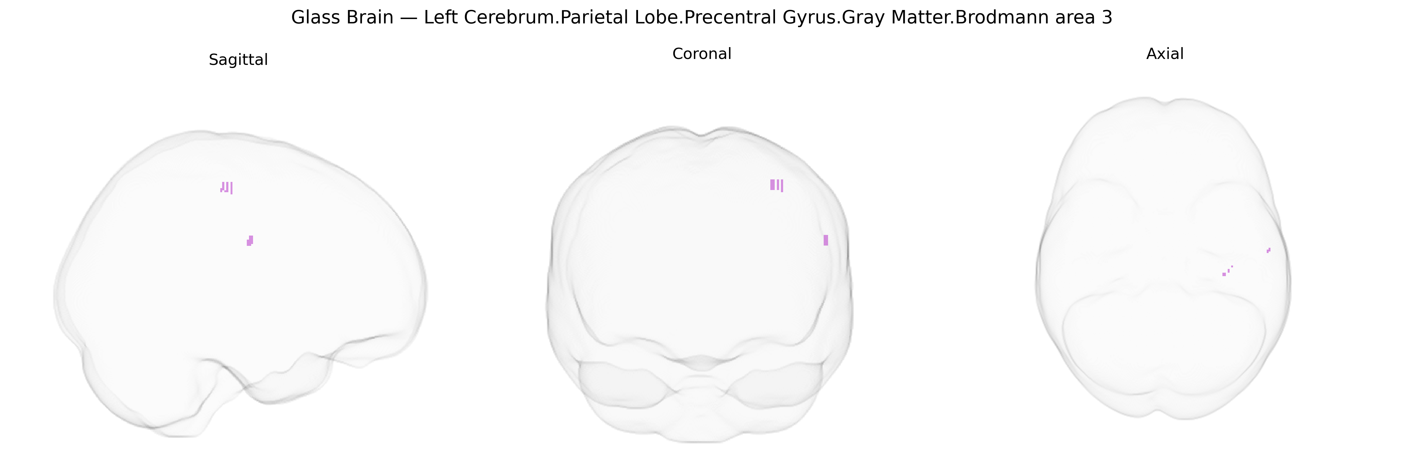 Triplanar Ghost Brain
