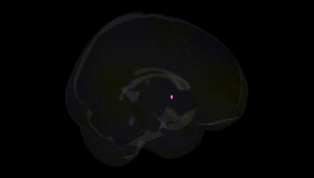 Full Brain Black