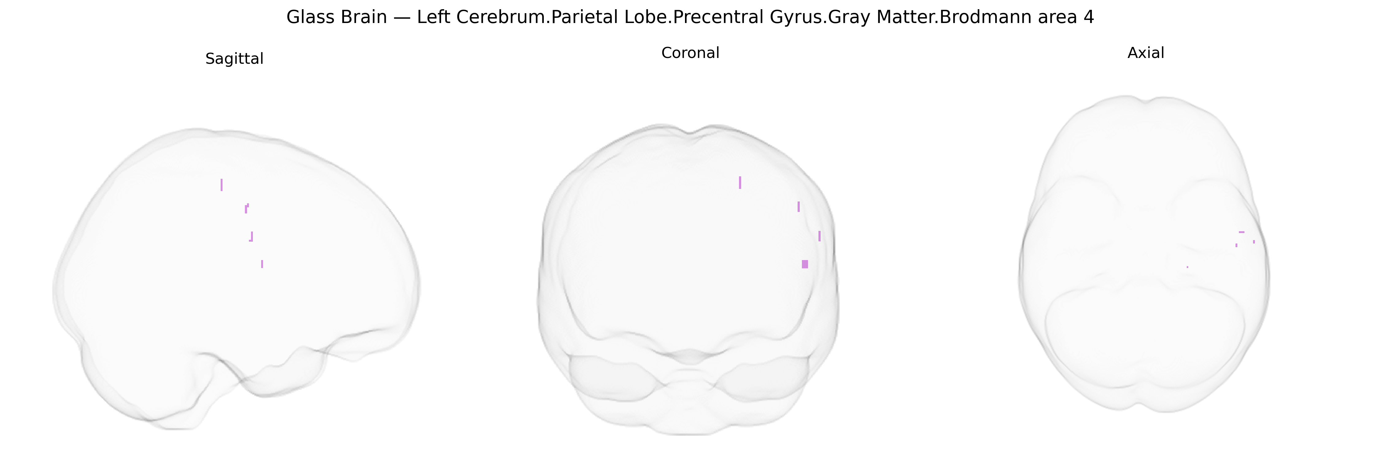 Triplanar Ghost Brain