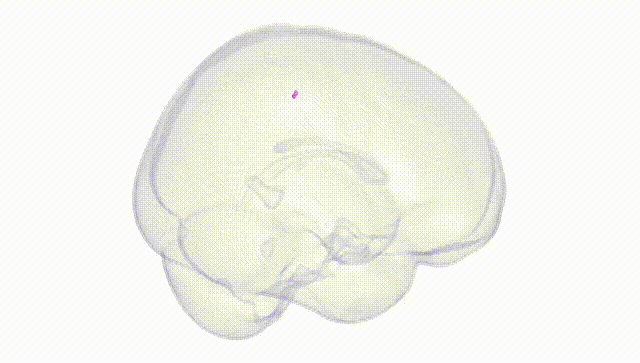 Full Brain White