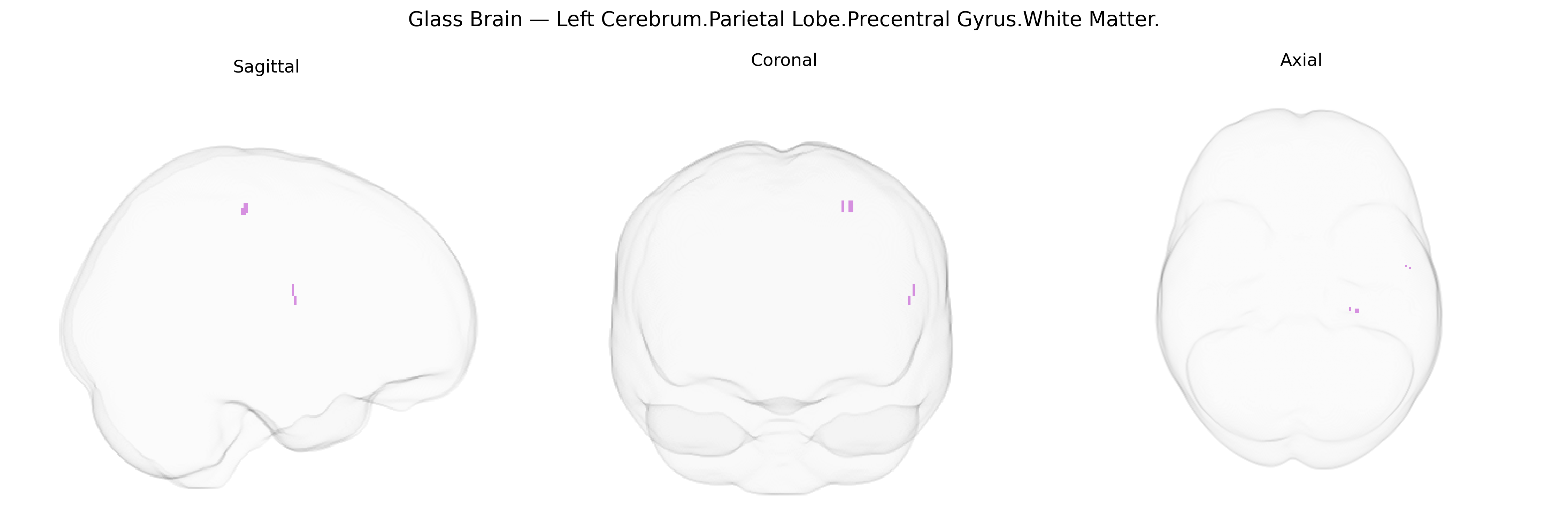 Triplanar Ghost Brain