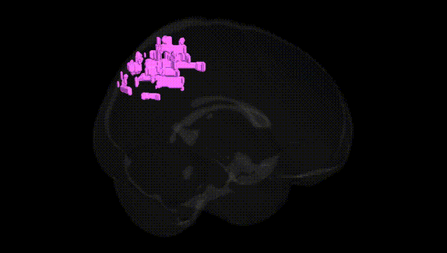 Full Brain Black