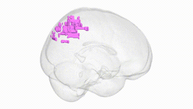 Full Brain White