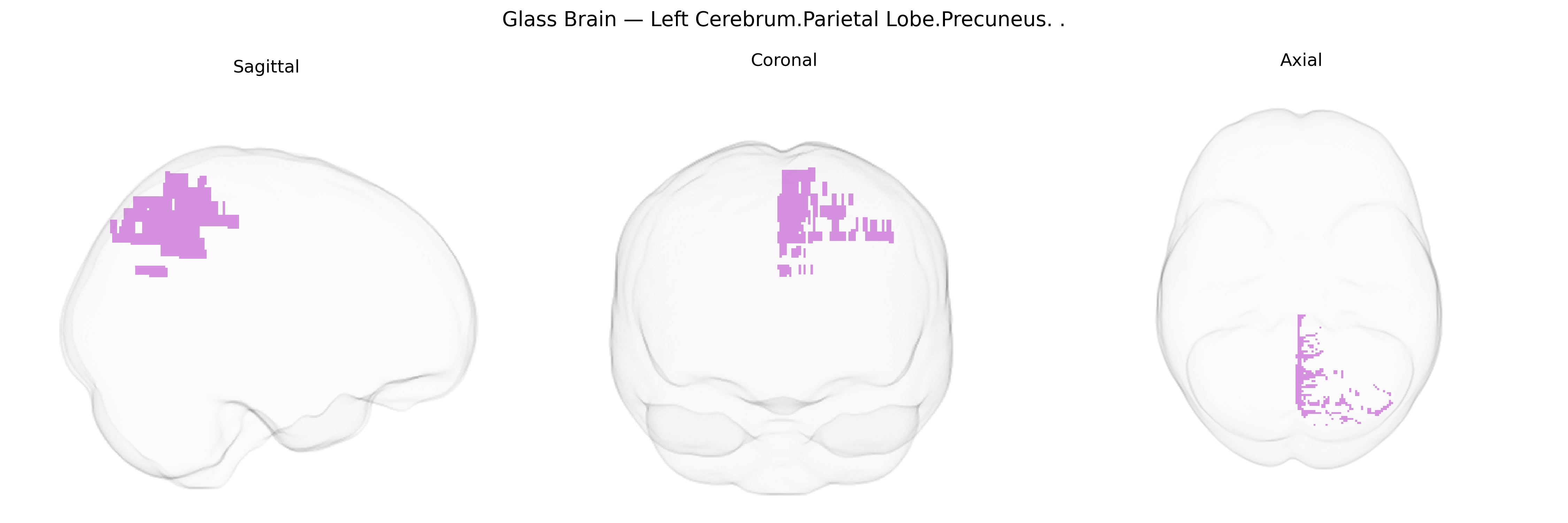 Triplanar Ghost Brain