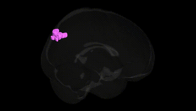 Full Brain Black
