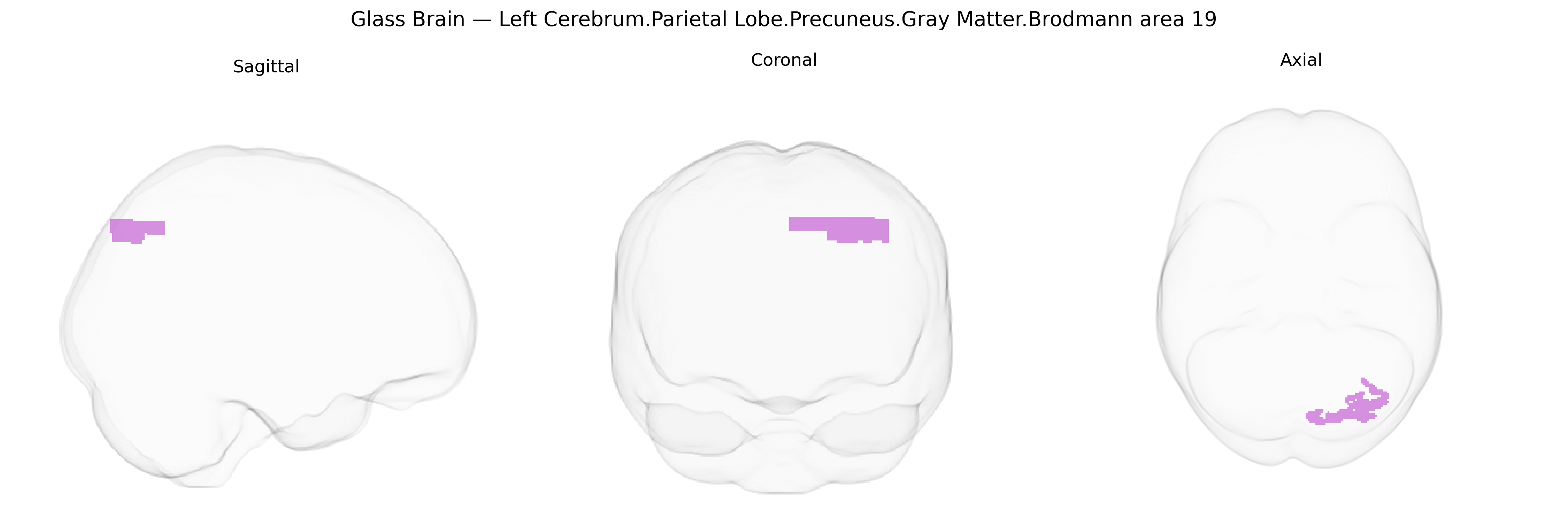 Triplanar Ghost Brain