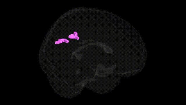 Full Brain Black