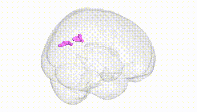 Full Brain White