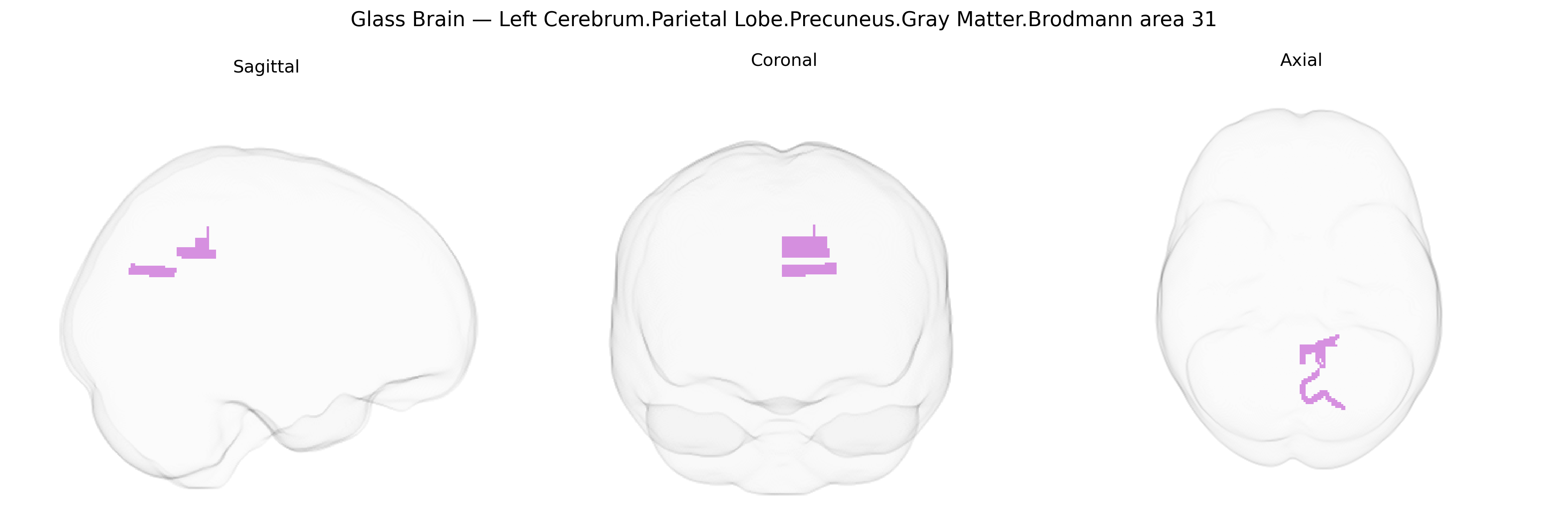 Triplanar Ghost Brain