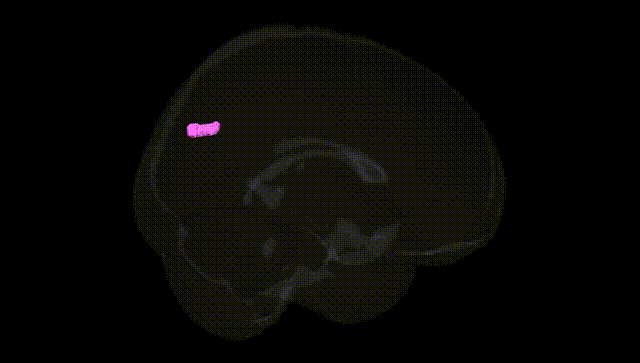 Full Brain Black