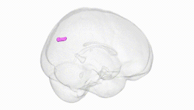 Full Brain White