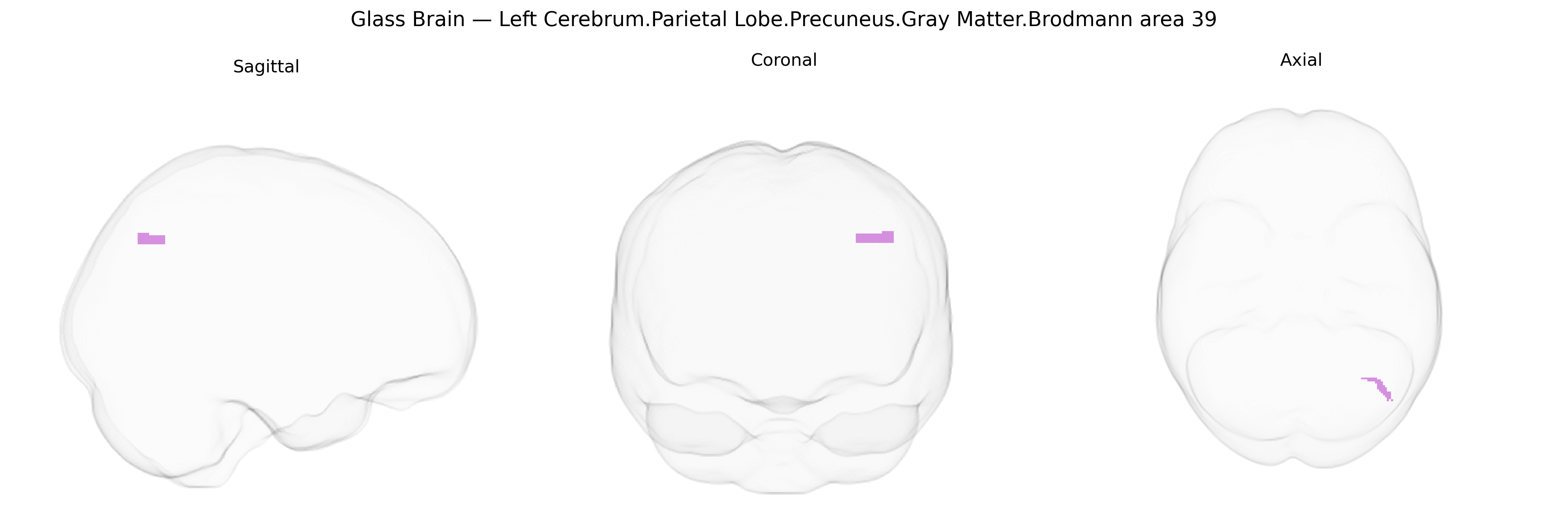 Triplanar Ghost Brain