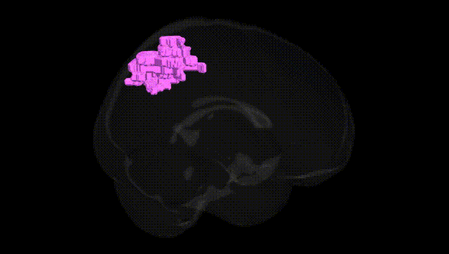 Full Brain Black