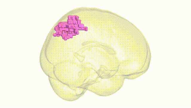 Full Brain White