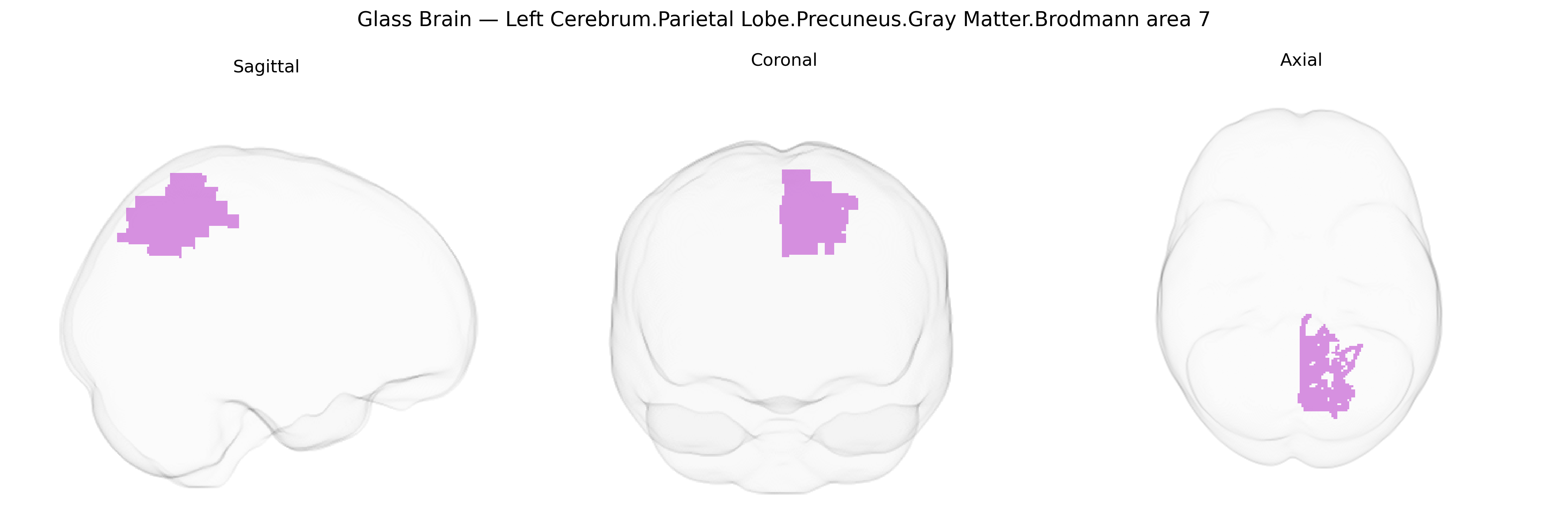 Triplanar Ghost Brain