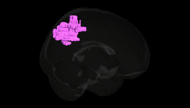 Full Brain Black