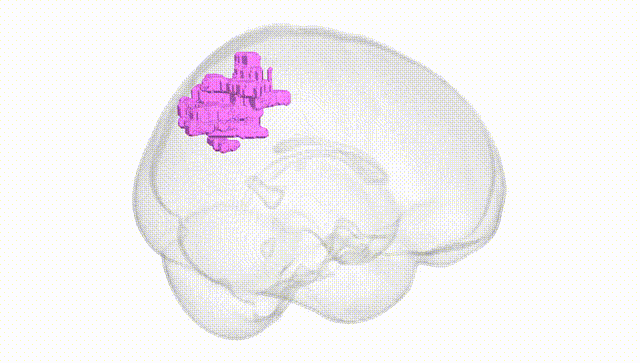 Full Brain White