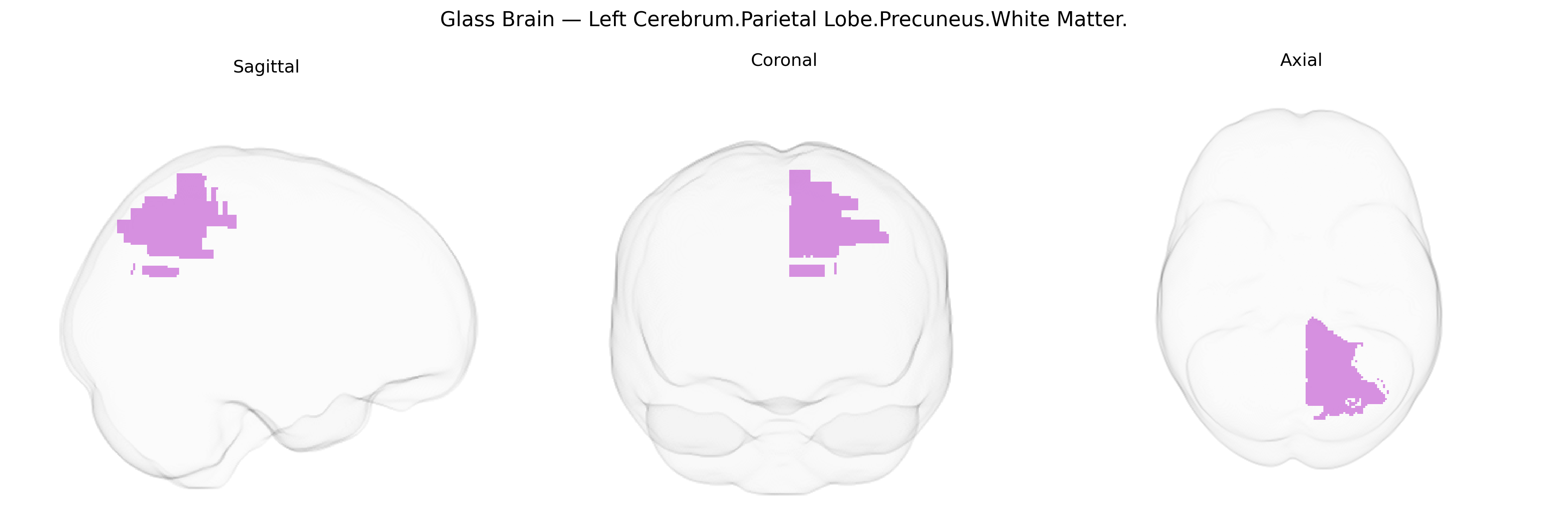 Triplanar Ghost Brain