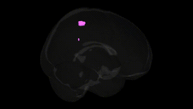 Full Brain Black