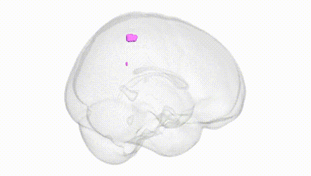 Full Brain White