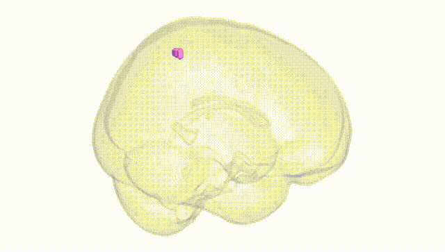 Full Brain White