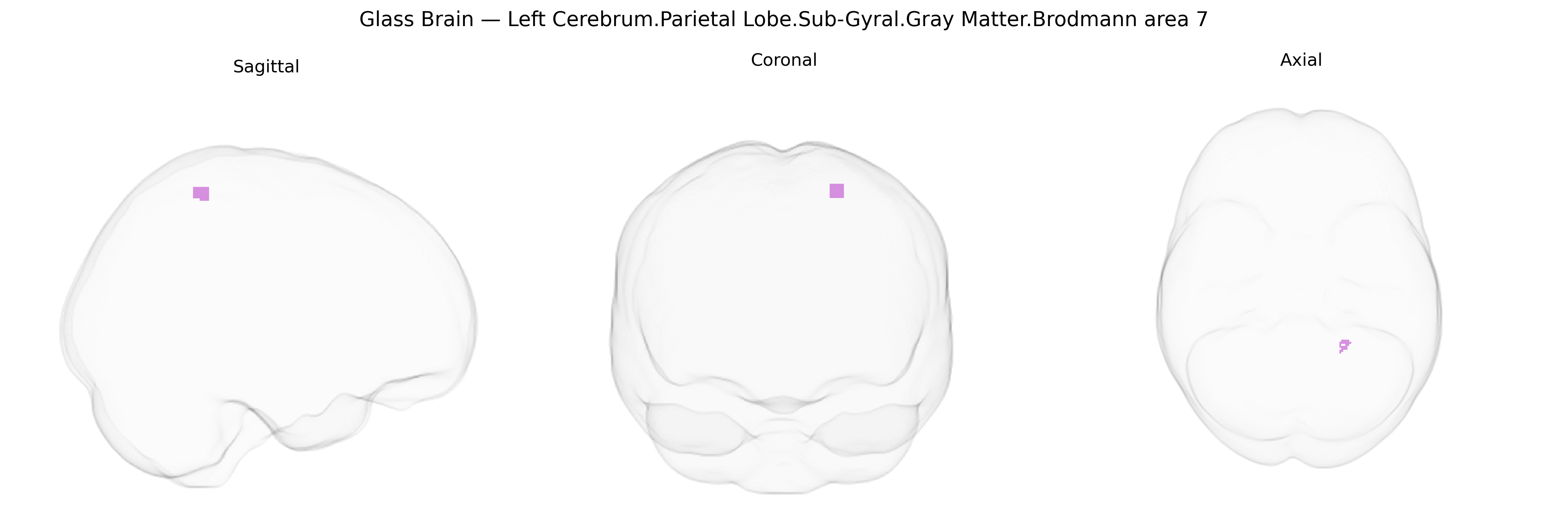 Triplanar Ghost Brain