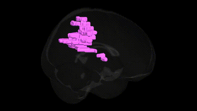 Full Brain Black