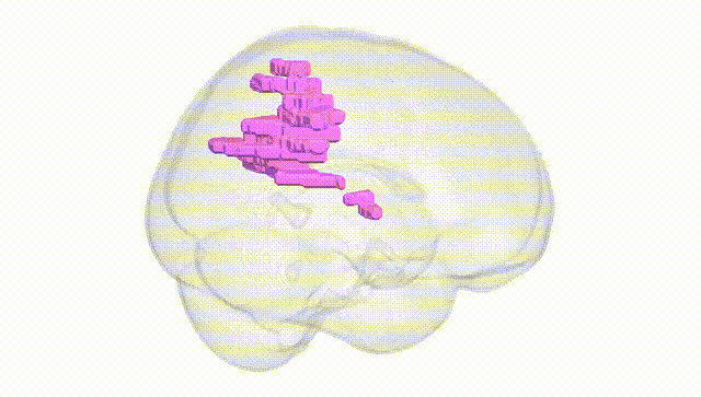Full Brain White