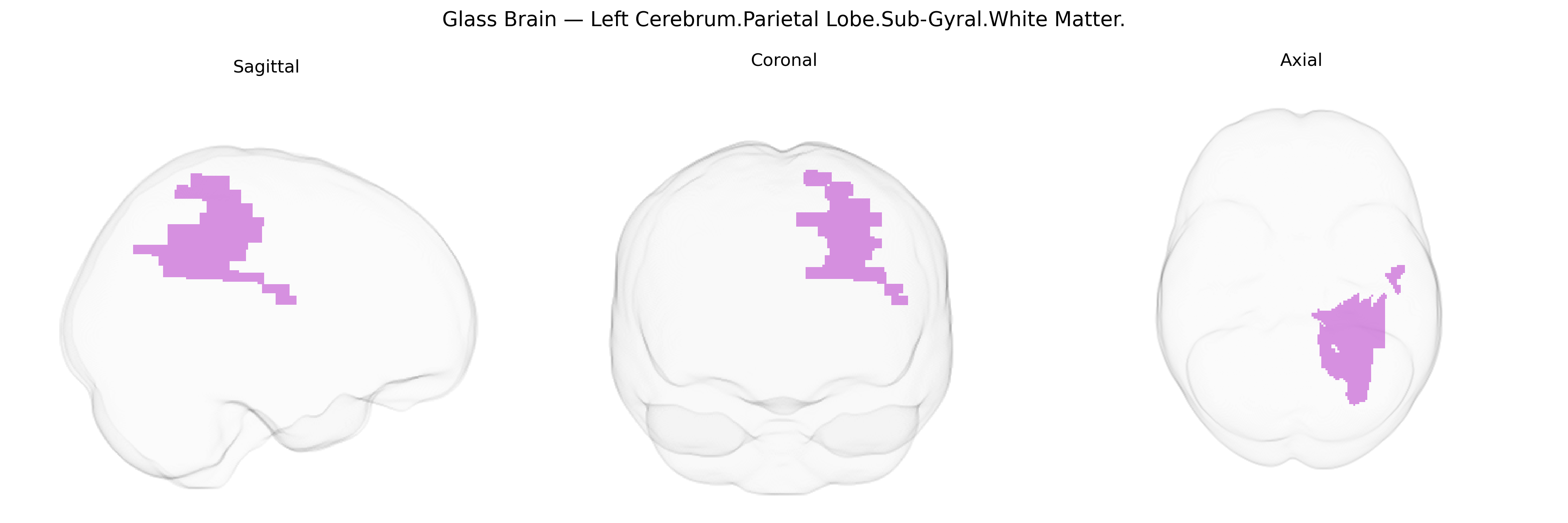 Triplanar Ghost Brain