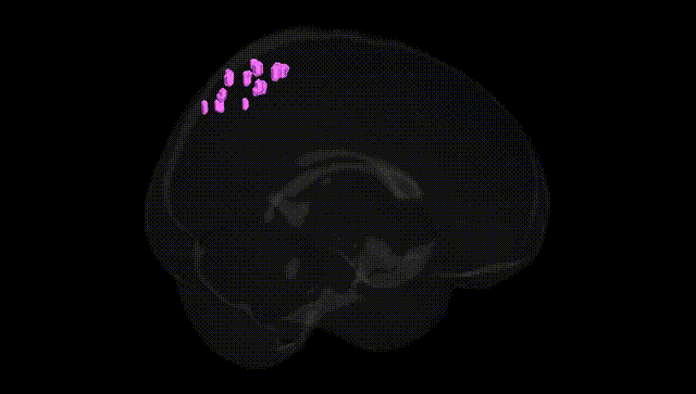 Full Brain Black