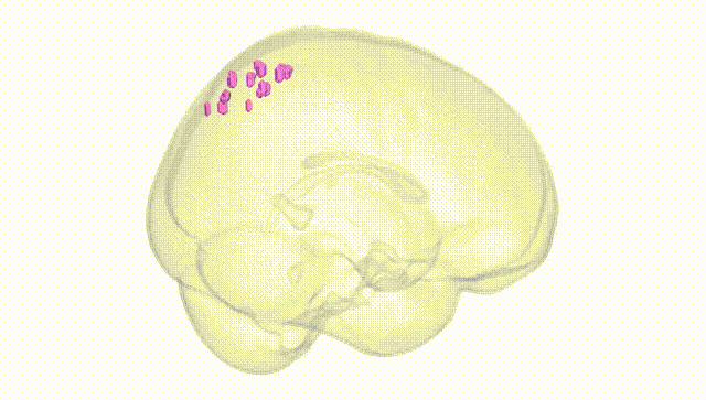 Full Brain White