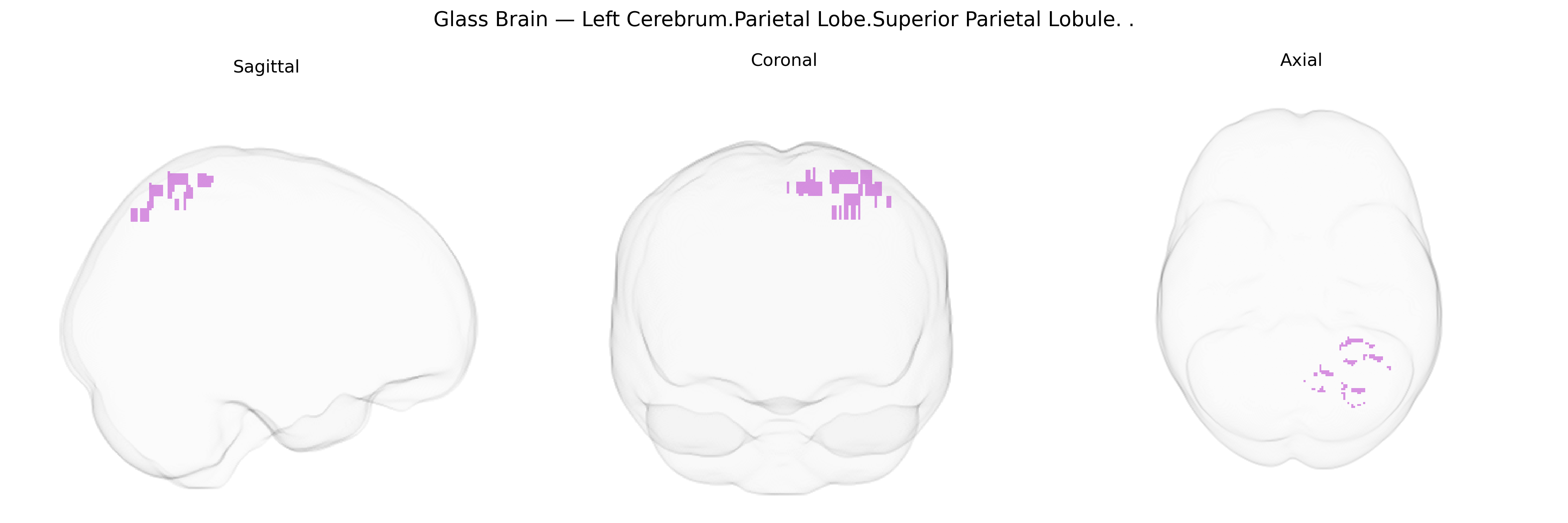 Triplanar Ghost Brain