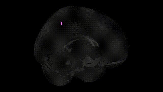 Full Brain Black