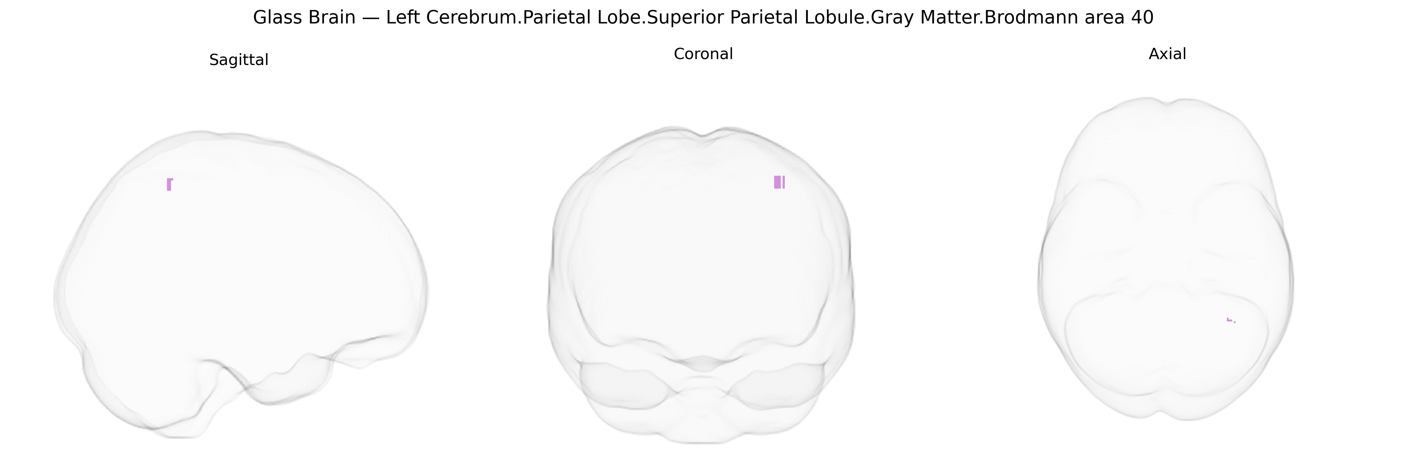 Triplanar Ghost Brain