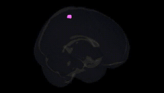 Full Brain Black