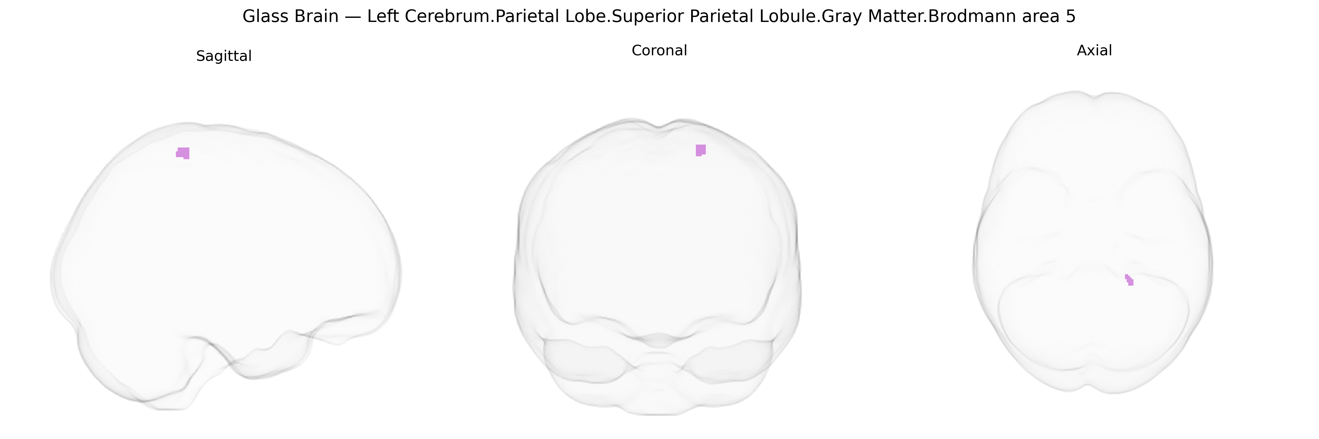 Triplanar Ghost Brain