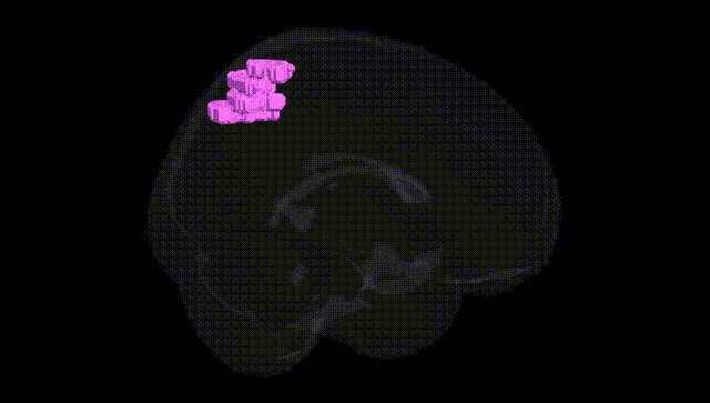 Full Brain Black