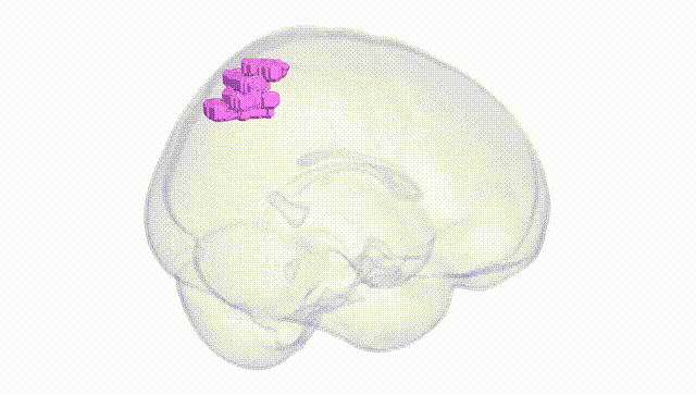 Full Brain White