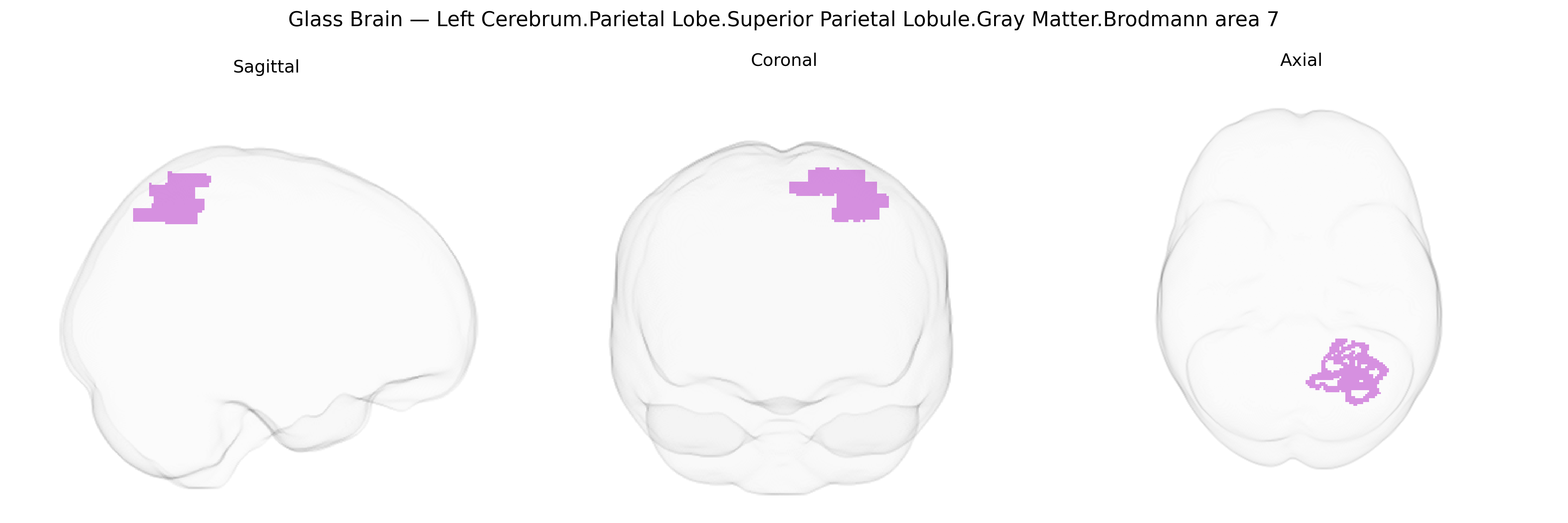 Triplanar Ghost Brain
