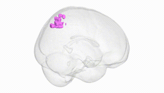 Full Brain White