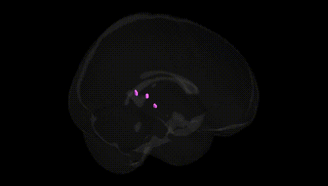Full Brain Black