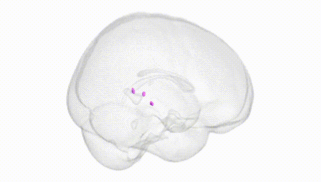 Full Brain White