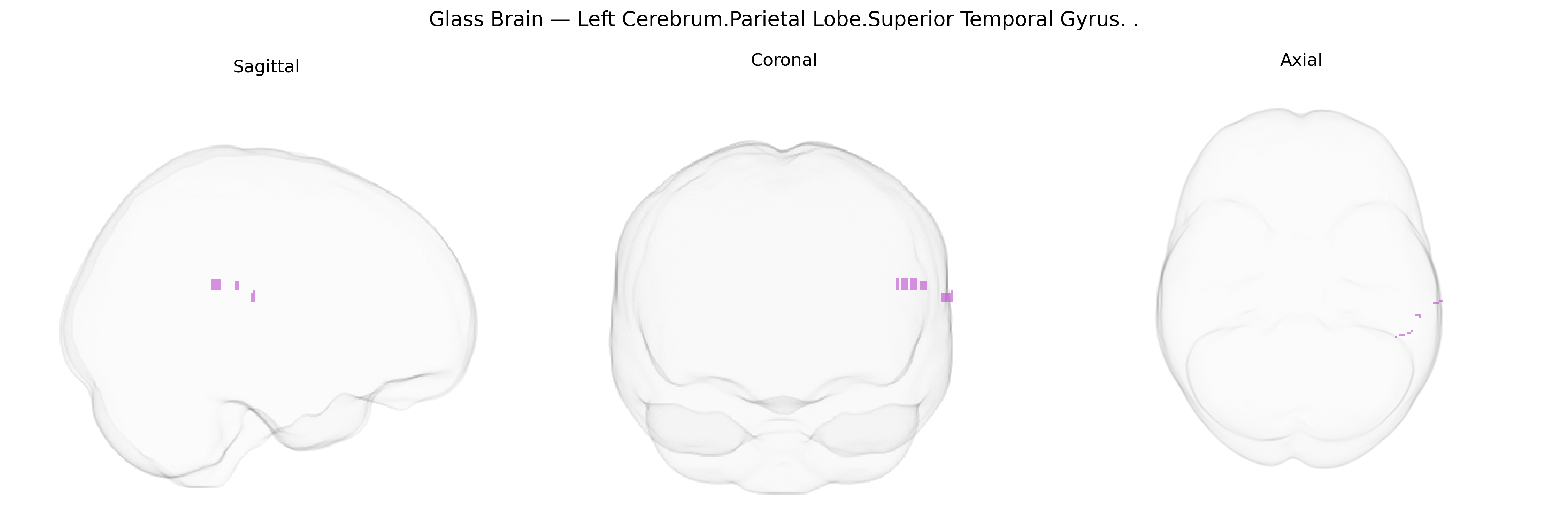 Triplanar Ghost Brain