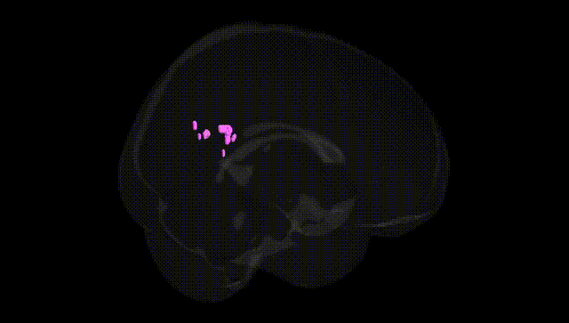 Full Brain Black