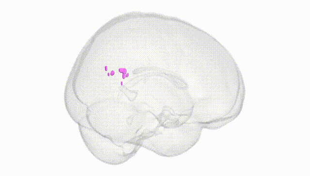 Full Brain White