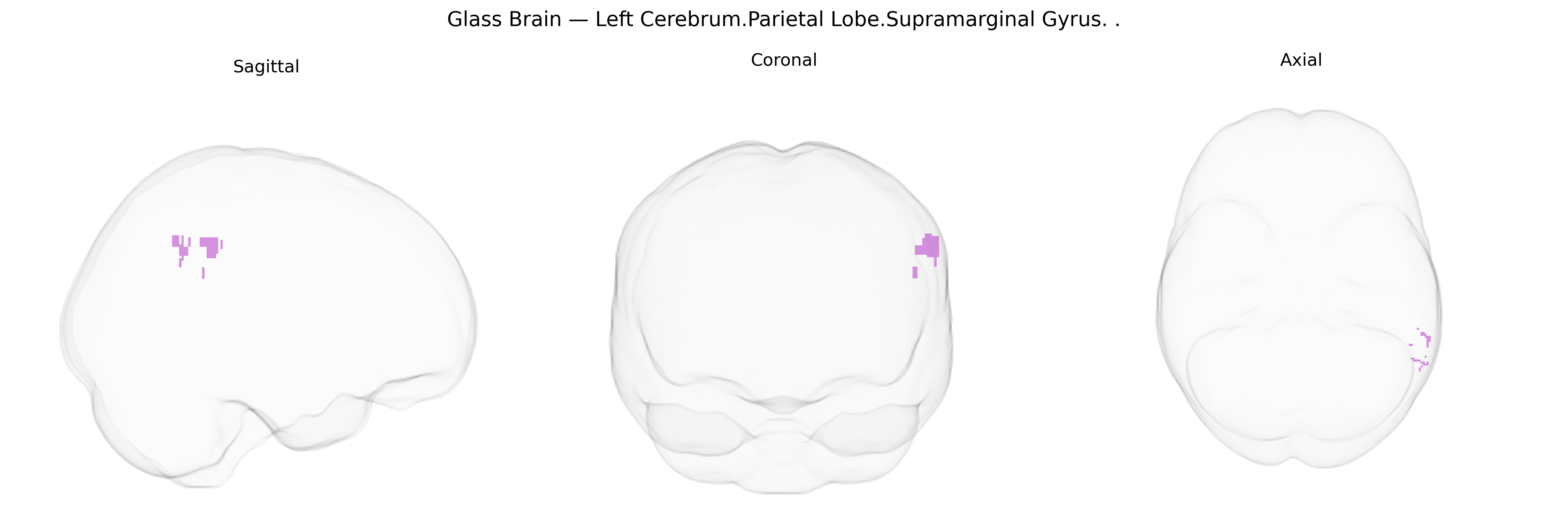 Triplanar Ghost Brain