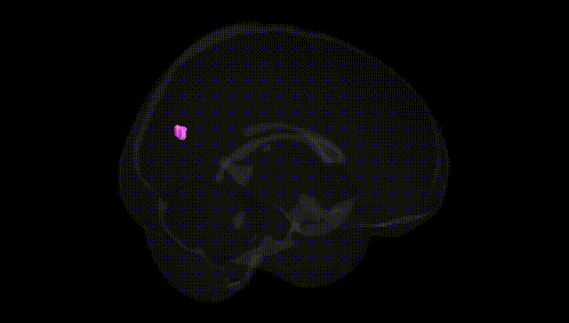 Full Brain Black