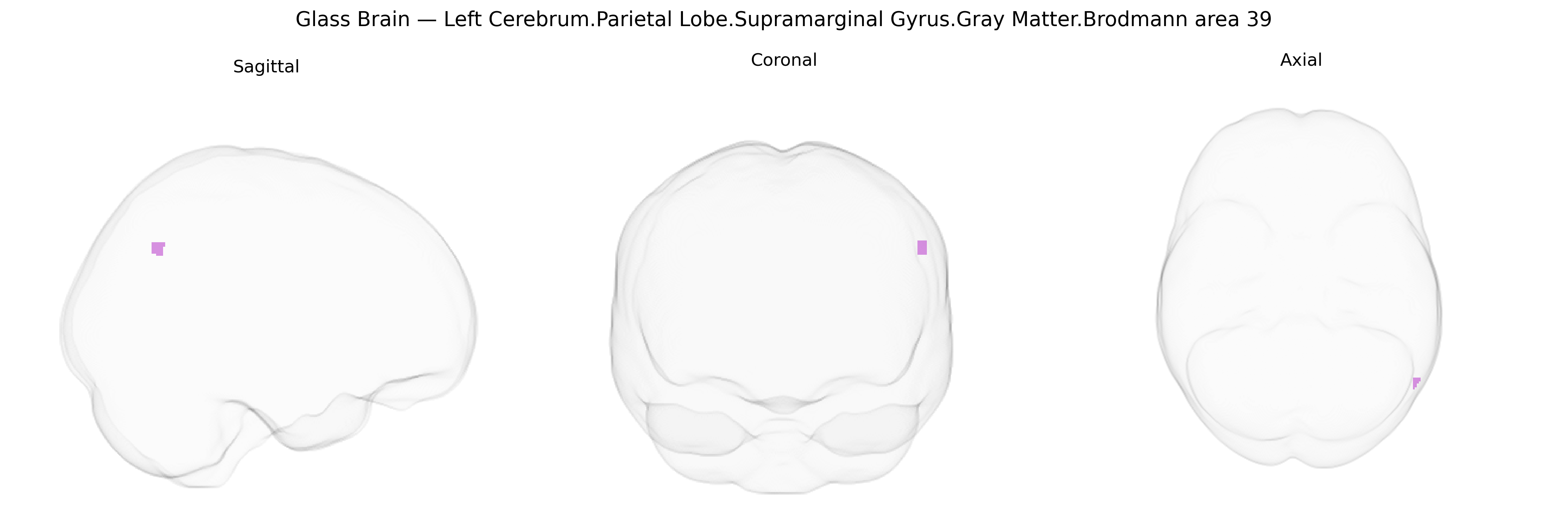 Triplanar Ghost Brain