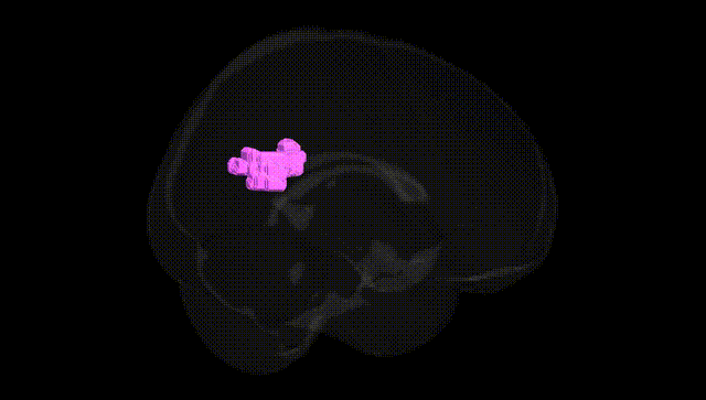 Full Brain Black