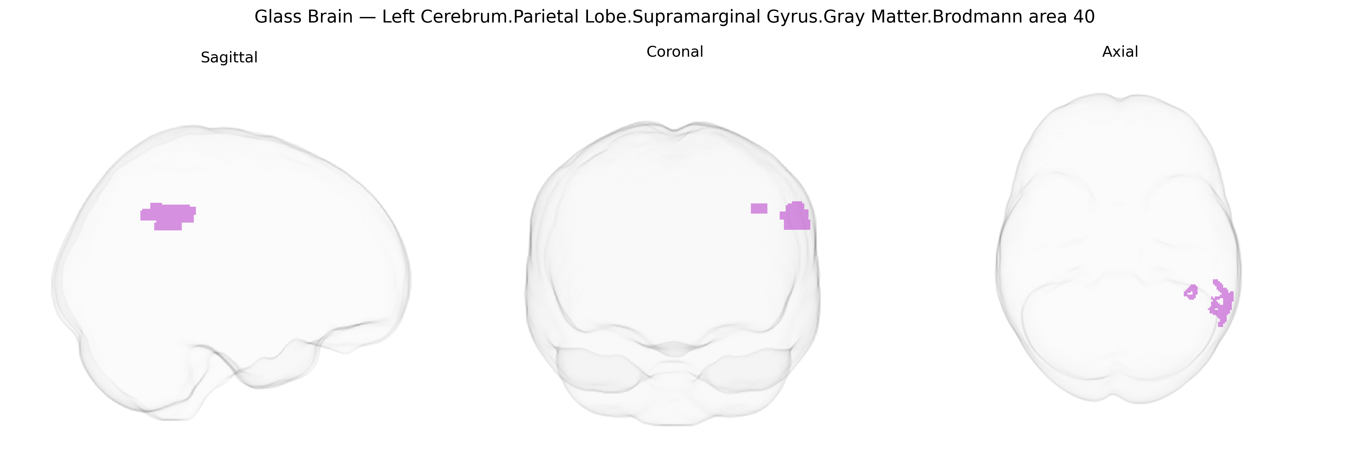 Triplanar Ghost Brain